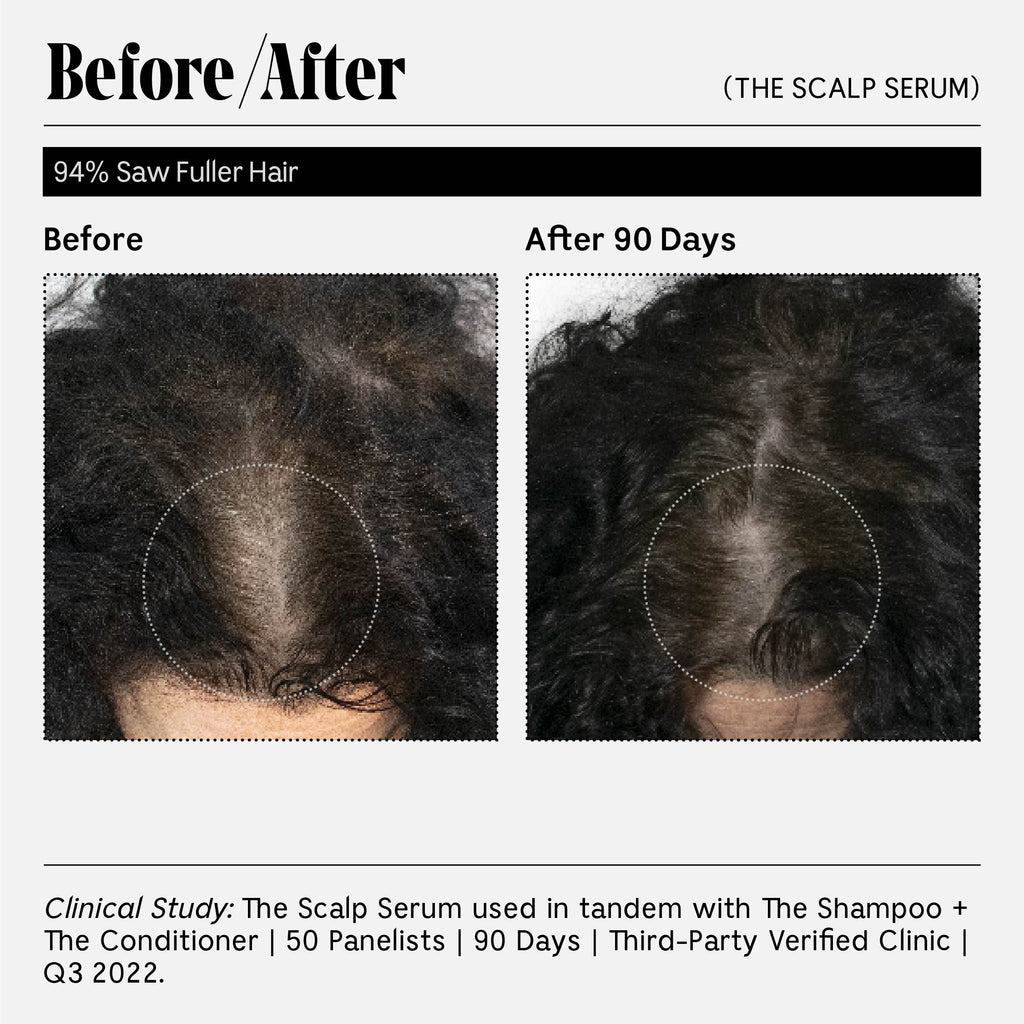 Nécessaire-The Scalp Serum-Hair-12_TheScalpSerum30ml-The Detox Market | 