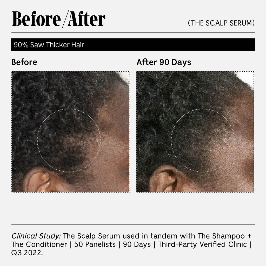 Nécessaire-The Scalp Serum-Hair-13_TheScalpSerum30ml-The Detox Market | 