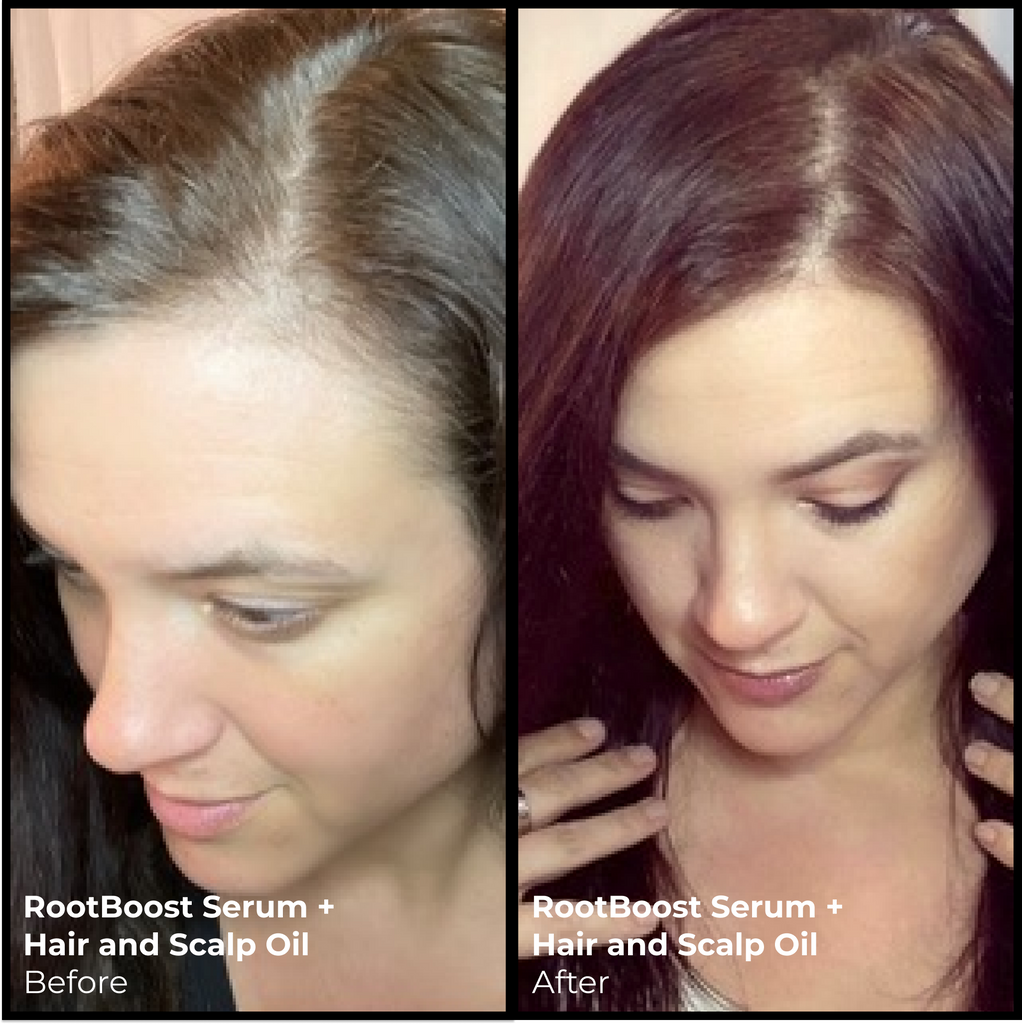 EVOLVh-Better Roots Scalp + Hair Oil-