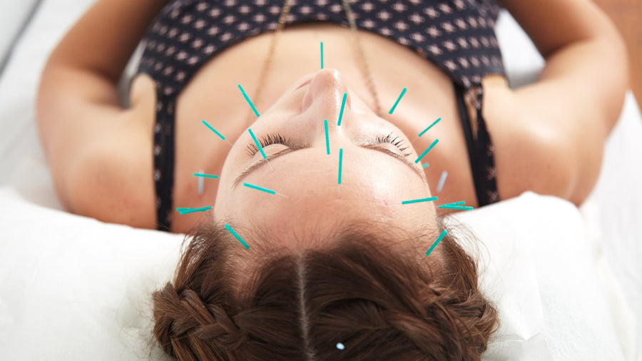 Facial Acupuncture: Benefits & What it Can Do For You