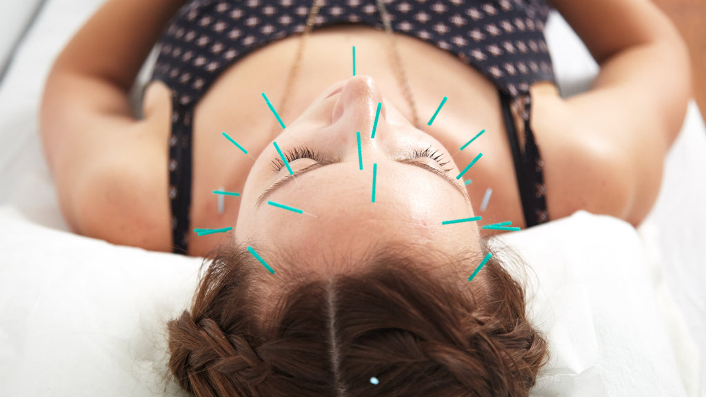 Facial Acupuncture: Benefits & What it Can Do For You-The Detox Market