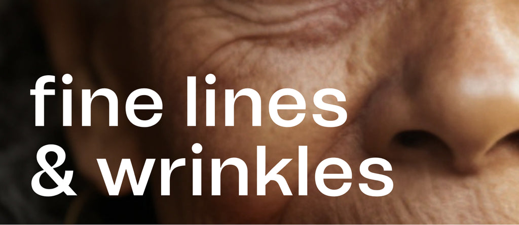 1x1_-_FINE_LINES_WRINKLES-The Detox Market