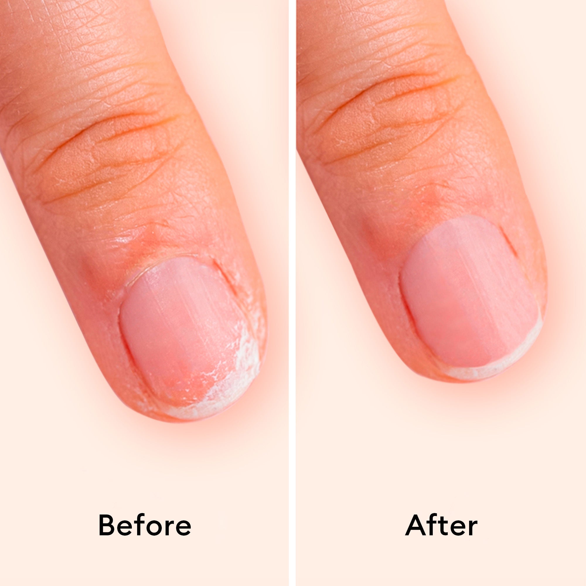 Manucurist-Strengthening Nail Care Set - 3-Step Manicure For Soft Nails-Makeup-3662263220495_3_EN-The Detox Market | 