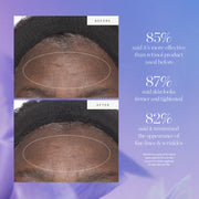 Kora Organics-Plant Stem Cell Retinol Alternative Moisturizer-