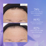 Kora Organics-Plant Stem Cell Retinol Alternative Serum-