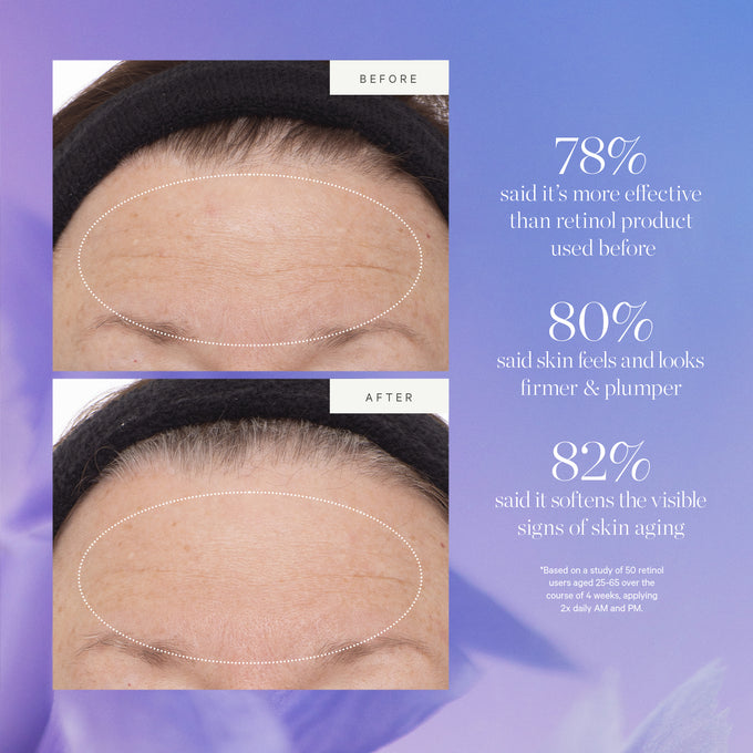 Kora Organics-Plant Stem Cell Retinol Alternative Serum-