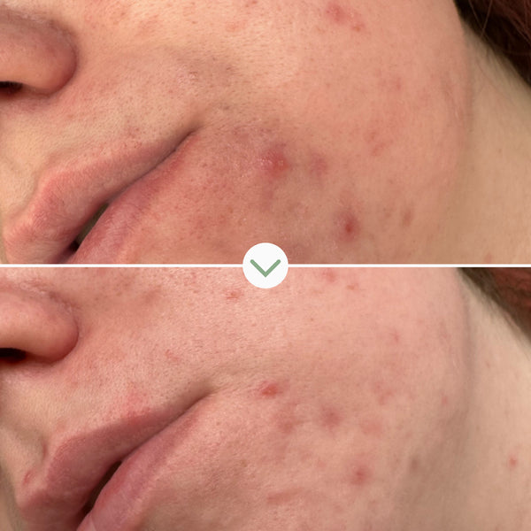 Pai Skincare-Phaze Rebalance Cleanser-Skincare-5060139729024_5_097258fa-06a8-4706-8c66-90990ee3630d-The Detox Market | 