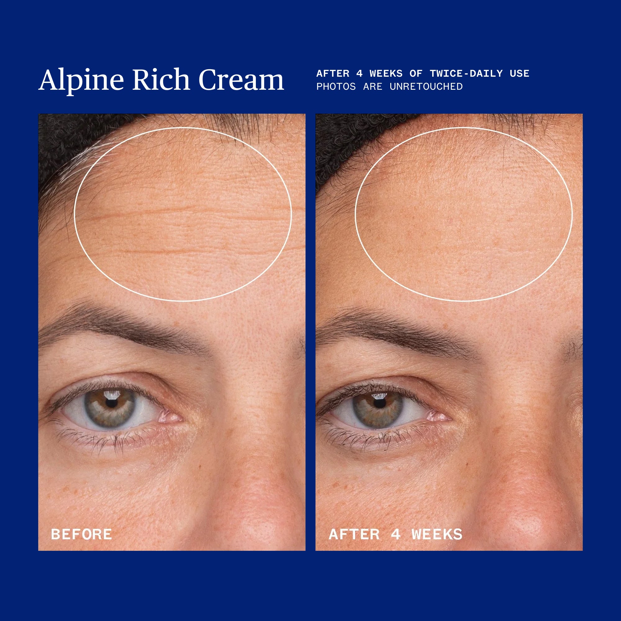 Ursa Major-Alpine Rich Cream-Skincare-Alpine-Rich-Cream-08_b9df0c4a-4d52-4a69-ad38-faf50ad64bf4-The Detox Market | 