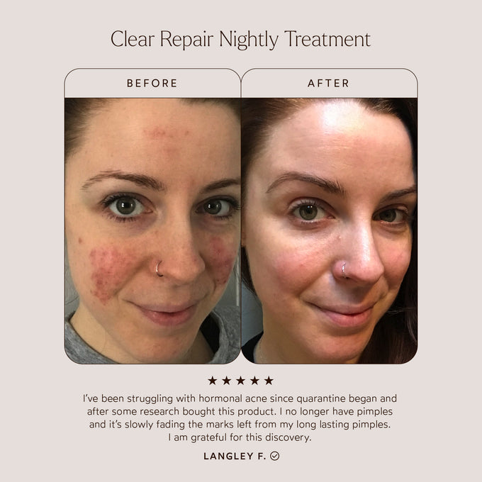 True Botanicals-CLEAR Repair Nightly Treatment-Skincare-BA1_ClearTreatment_2048x2048_a641f0d3-d3ef-4e84-9566-21c18144e626-The Detox Market | 