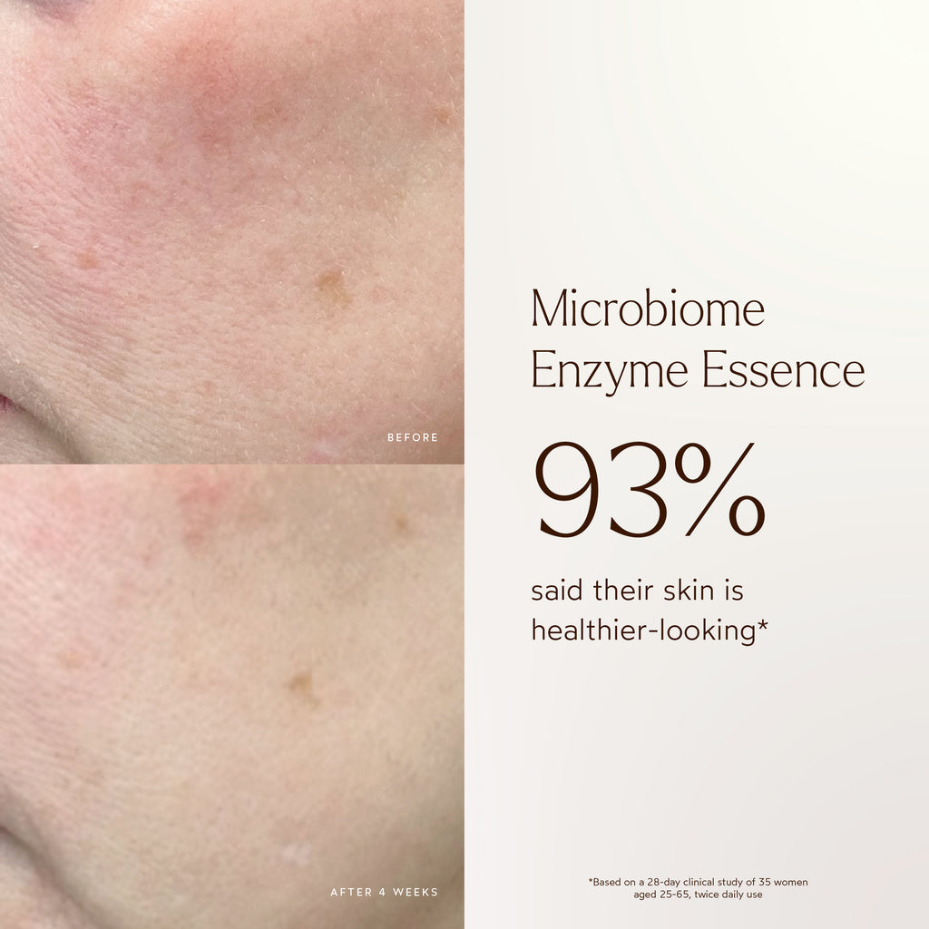 True Botanicals-Renew Microbiome Enzyme Essence-Skincare-BA1_Essence_2048x2048_c666b35a-131d-419c-92ac-9ea19c0a9aa0-The Detox Market | 