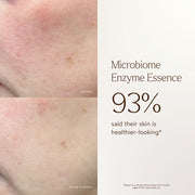 True Botanicals-Renew Microbiome Enzyme Essence-Skincare-BA1_Essence_2048x2048_c666b35a-131d-419c-92ac-9ea19c0a9aa0-The Detox Market | 