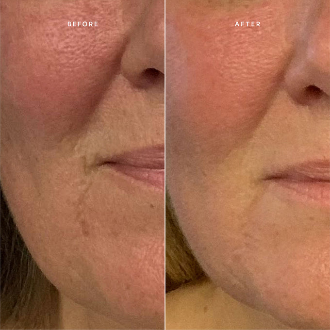 True Botanicals-RENEW Repair Nightly Treatment-Skincare-BA1_NightlyTreatment_2048x2048_a87fddd9-1042-42db-8e26-09ecffbb41bc-The Detox Market | 