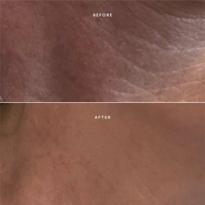 True Botanicals-RENEW Repair Nightly Treatment-Skincare-BA2_NightlyTreatment_2048x2048_05461f50-04f5-4757-b4b7-a0e2cb7ffe4a-The Detox Market | 