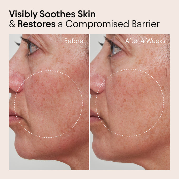 Alpyn Beauty-Barrier Repair Cream-Skincare-BarrierRepairCream_3-The Detox Market | 