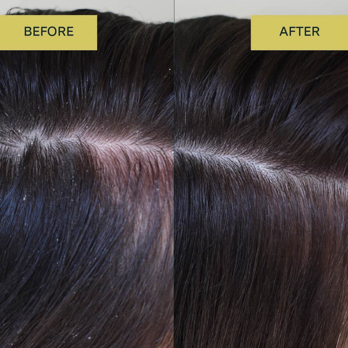 Rahua-Aloe Vera Shampoo-Hair-Before-And-After-Aloe-Vera-Shampoo-Conditioner-The Detox Market | 