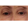 Maya Chia-The Advanced Eye Response Complex-