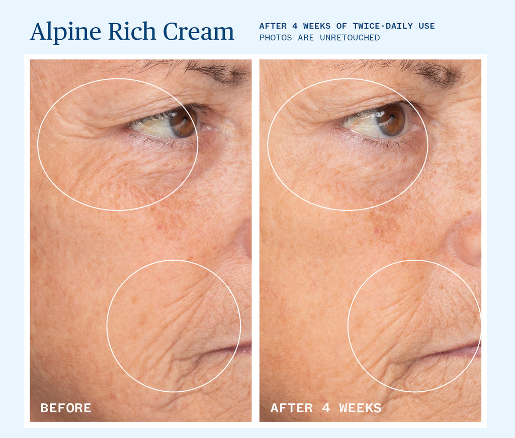 Ursa Major-Alpine Rich Cream-Skincare-BeforeAndAfter_PDP_RichCream_01-The Detox Market | 