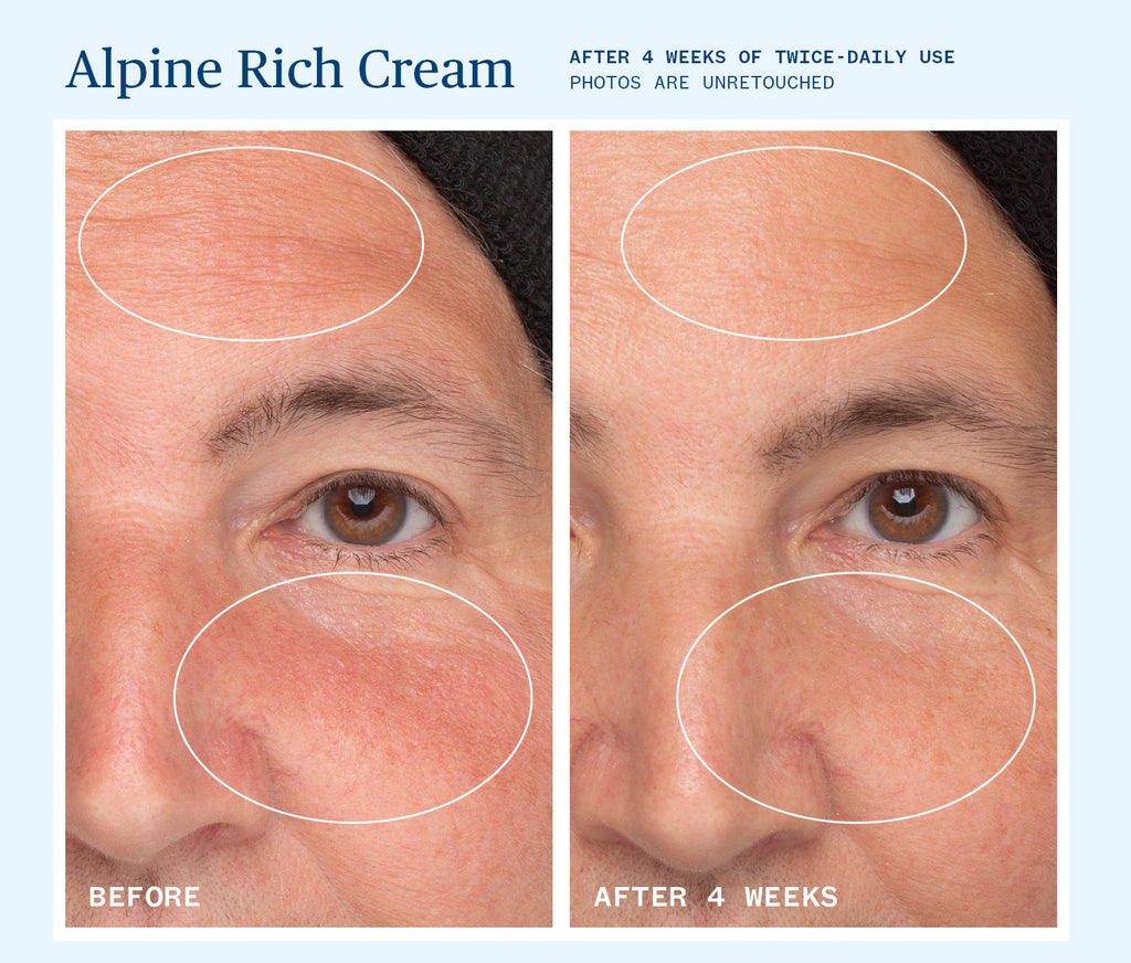 Ursa Major-Alpine Rich Cream-Skincare-BeforeAndAfter_PDP_RichCream_03-The Detox Market | 