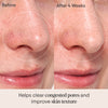 Alpyn Beauty-Clarifying Facial Oil With Retinol & Pink Algae-Skincare-ClarifyingFacialOil_4-The Detox Market | 