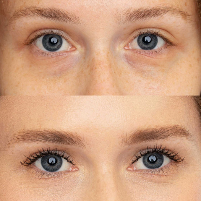 Correct + - Makeup - Fitglow Beauty - Corrector_Eyebright_BA_01_DTC - The Detox Market | Eyebright