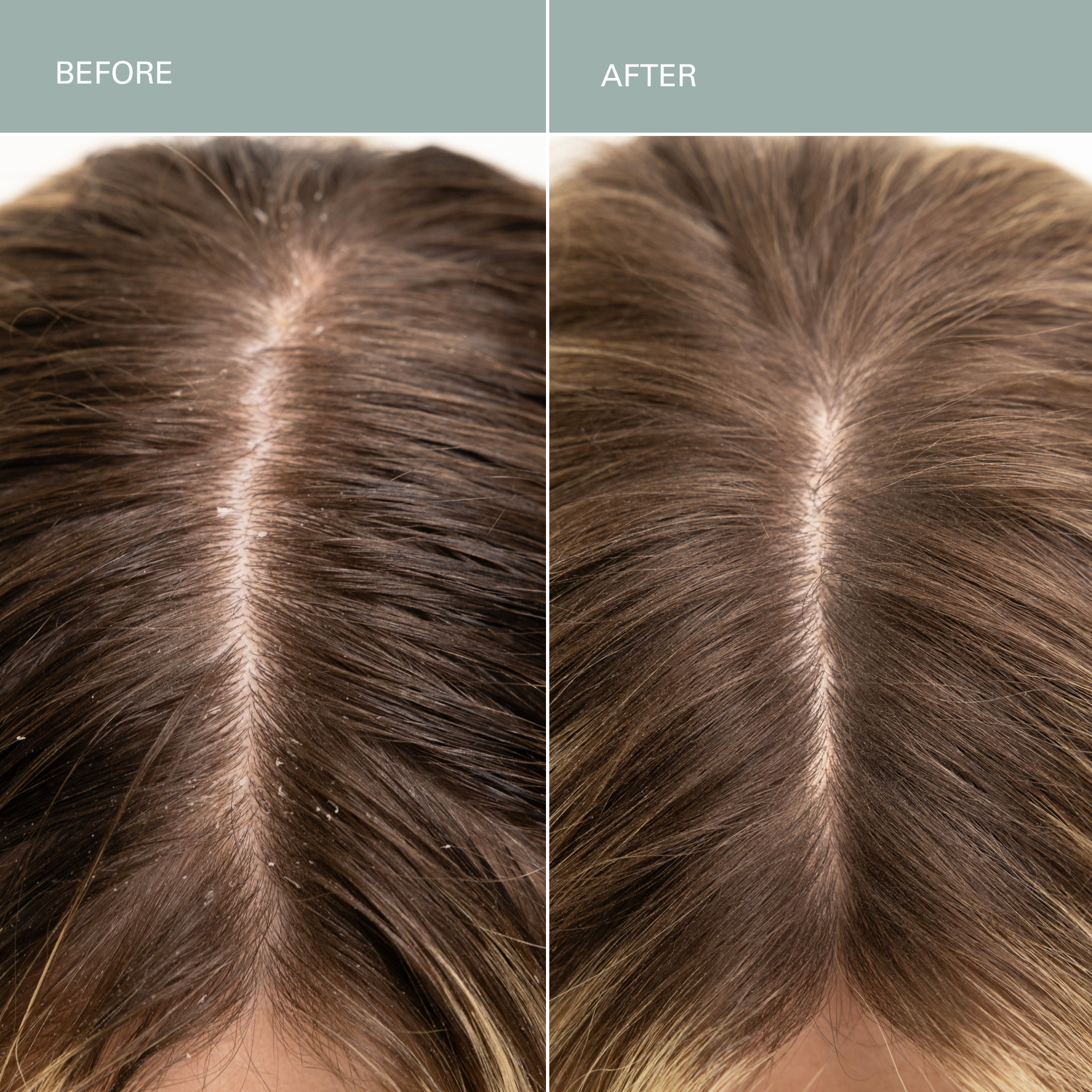 RŌZ-Salt Scalp Scrub Exfoliating Detox Shampoo-Hair-FGRZSCSCB0000_02_3c3bed24-7fc1-4a35-938b-c2af7c7700c6-The Detox Market | 