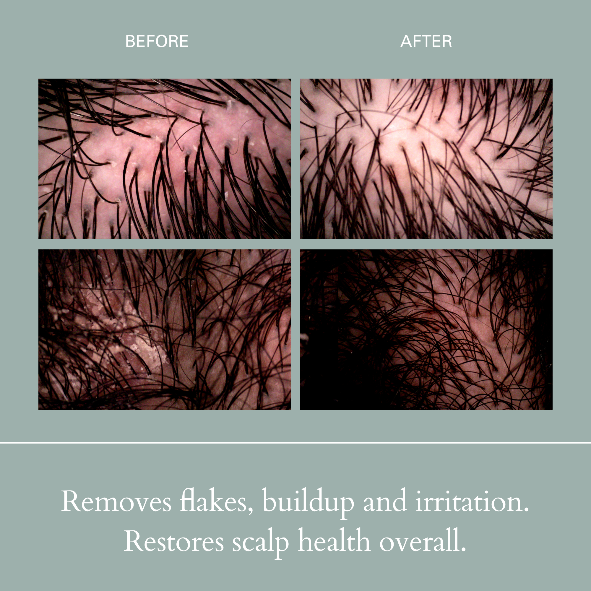 RŌZ-Salt Scalp Scrub Exfoliating Detox Shampoo-Hair-FGRZSCSCB0000_04_fc379772-3530-45b8-90a1-976601053ca4-The Detox Market | 