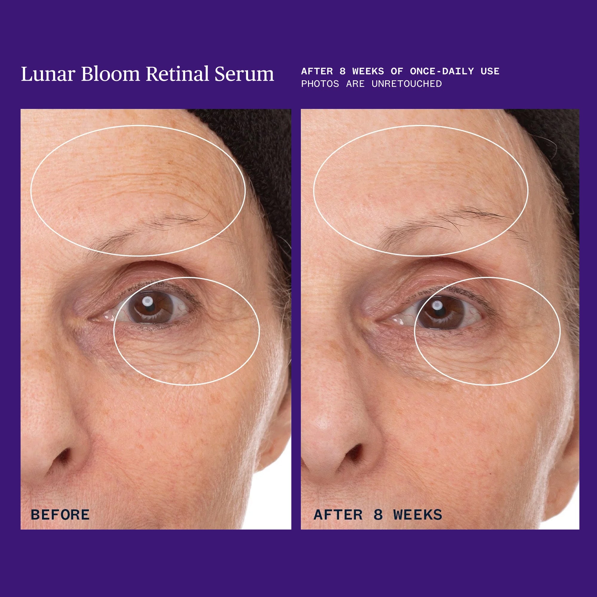 Ursa Major-Lunar Bloom Retinal Serum-Skincare-Lunar-Bloom-Retinal-Serum-09_cb3ddcee-a2f5-4891-8a62-b631b964361e-The Detox Market | 