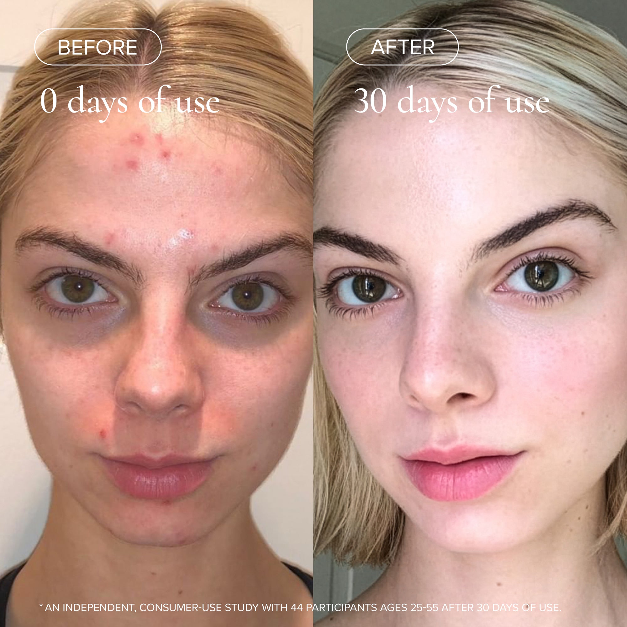 Evening Primrose + Green Tea Algae Retinol Face Oil – The Detox Market