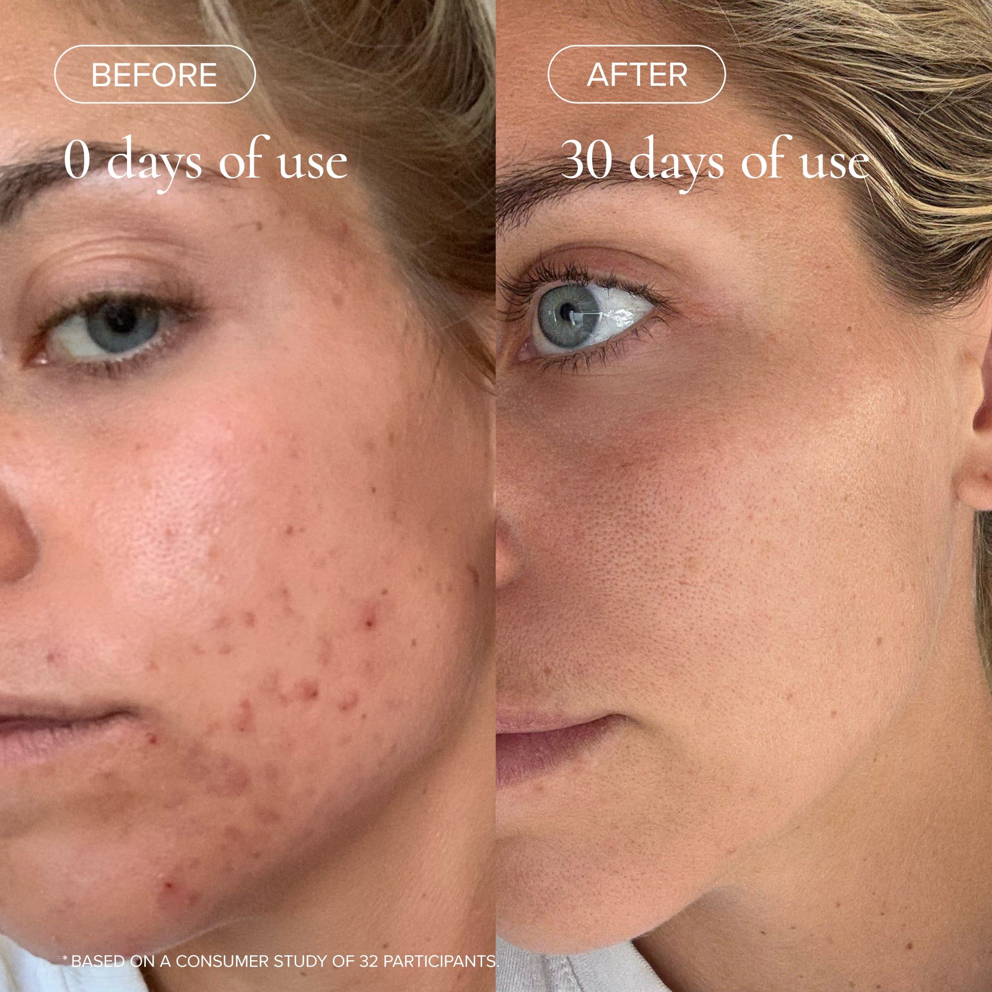 MARA-Flower Acid Algae Serum-Skincare-MARA-FAAS-30_4_e1a32e24-e444-48b6-9ef8-95b46a9f4dd1-The Detox Market | 