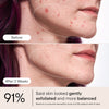 Alpyn Beauty-Pore Perfecting Liquid with 2% BHA + Borage-Skincare-PorePerfectingLiquid3-The Detox Market | 