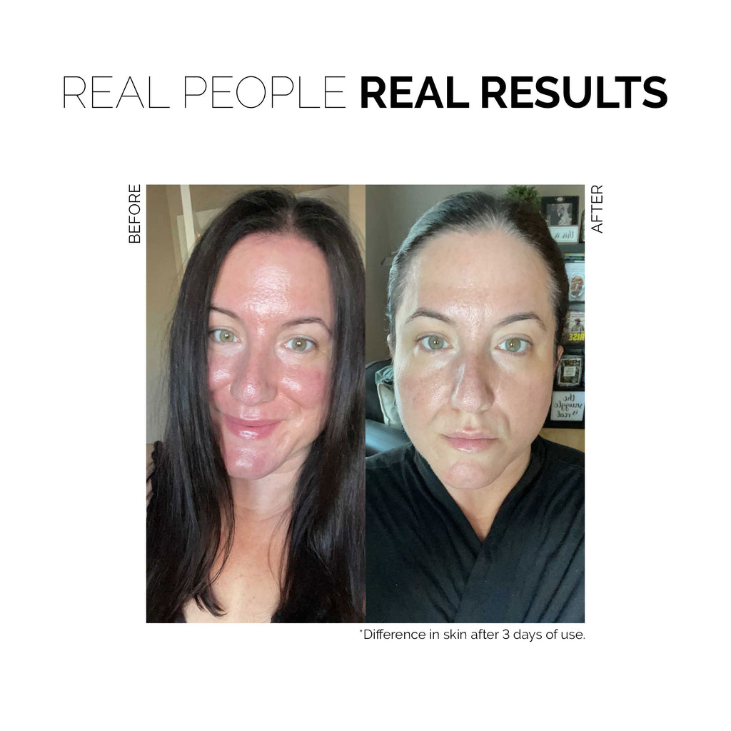 Fitglow Beauty-Redness Rescue Cream-Skincare-RRC_before_after_a8eb222f-ef63-4b11-8462-bc77e744dd94-The Detox Market | 