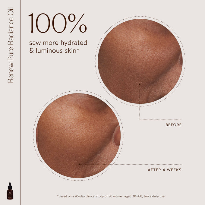 The Detox Market-Radiant Repair Night Ritual-RetailResizeBefore_Afters3-11-The Detox Market | 