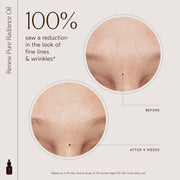 The Detox Market-Radiant Repair Night Ritual-RetailResizeBefore_Afters3-17_270ce81d-9601-45d1-bae3-2e13ed061165-The Detox Market | 