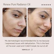 The Detox Market-Radiant Repair Night Ritual-RetailResizeBefore_Afters4-05_28c47695-99ec-49b5-b2a5-7206cfd12f27-The Detox Market | 