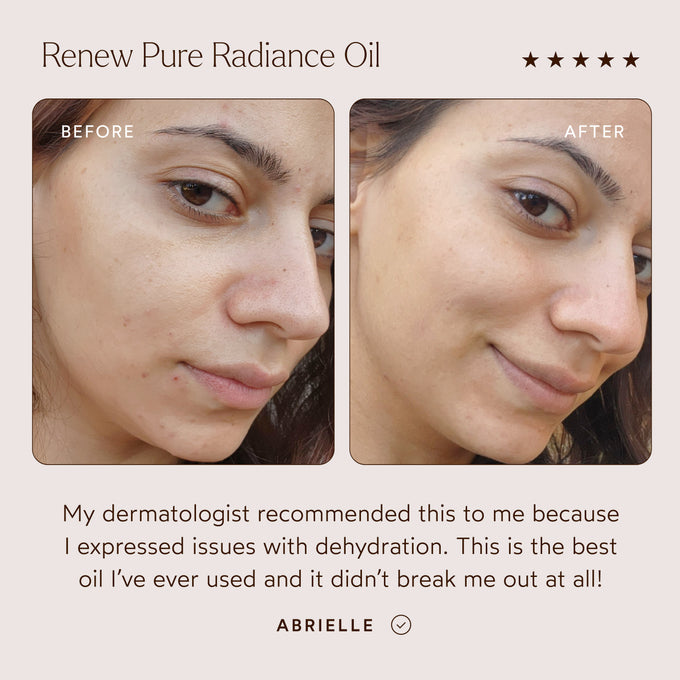 The Detox Market-Radiant Repair Night Ritual-RetailResizeBefore_Afters4-05_28c47695-99ec-49b5-b2a5-7206cfd12f27-The Detox Market | 