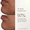 True Botanicals-At-Home Facialist Peel-Skincare-S-W-D-AHPL-R-4_0aa96a7a-86a3-43cd-afae-f978e69ca4dd-The Detox Market | 