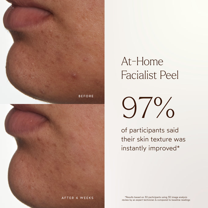 True Botanicals-At-Home Facialist Peel-Skincare-S-W-D-AHPL-R-4_0aa96a7a-86a3-43cd-afae-f978e69ca4dd-The Detox Market | 