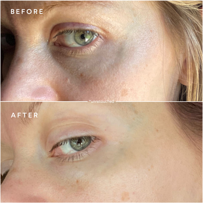 True Botanicals-Deep Repair Eye Serum-Skincare-S-W-D-DRES-R-6-The Detox Market | 