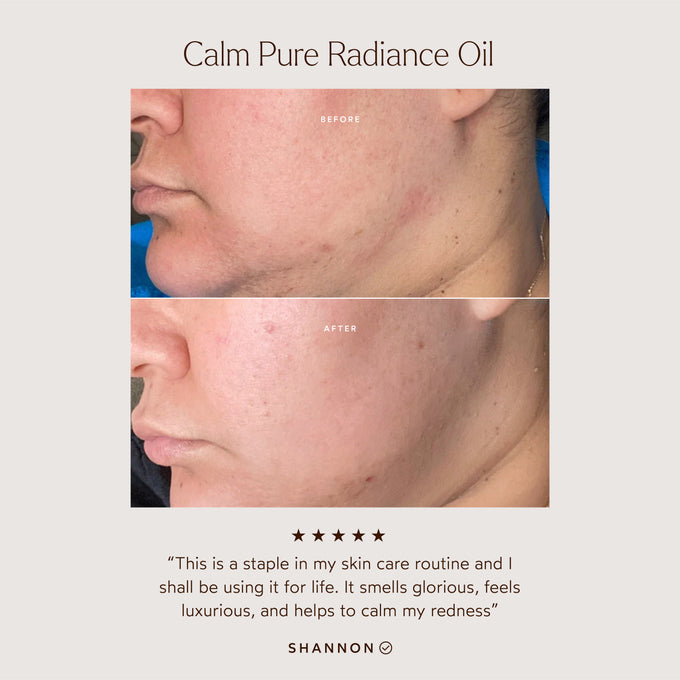 True Botanicals-CALM Pure Radiance Oil-Skincare-S-W-D-PRCM-R-3_b61558aa-8533-40ef-a627-67a06e2f2038-The Detox Market | 