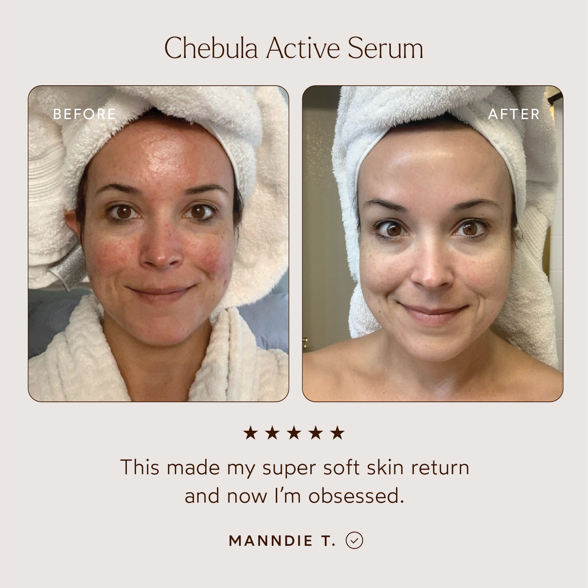 True Botanicals True Botanicals Chebula Active Serum Renew Immunity ...