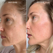 True Botanicals-Radiant Glow Discovery Set-Skincare-S-W-K-RGDC-K-6-The Detox Market | 