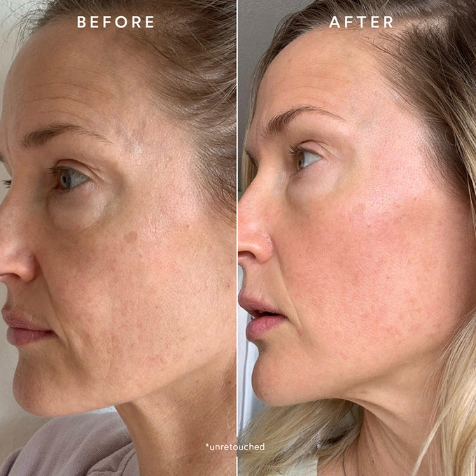 True Botanicals-Radiant Glow Discovery Set-Skincare-S-W-K-RGDC-K-6-The Detox Market | 