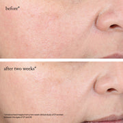 Goop-GOOPGLOW 15% Glycolic Acid Overnight Glow Peel-Skincare-overnightglowpeel_imgCarousel_beforeandafters-The Detox Market | 