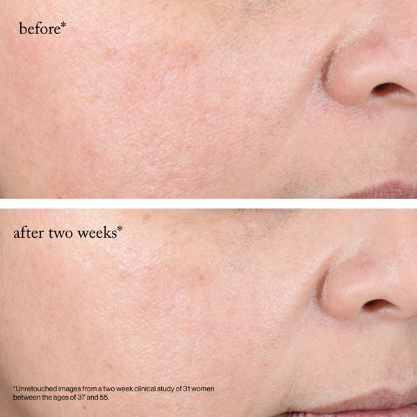 Goop-GOOPGLOW 15% Glycolic Acid Overnight Glow Peel-Skincare-overnightglowpeel_imgCarousel_beforeandafters-The Detox Market | 