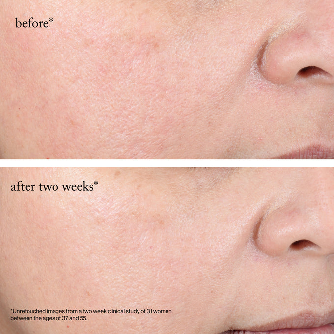 Goop-GOOPGLOW 15% Glycolic Acid Overnight Glow Peel-Skincare-overnightglowpeel_imgCarousel_beforeandafters-The Detox Market | 