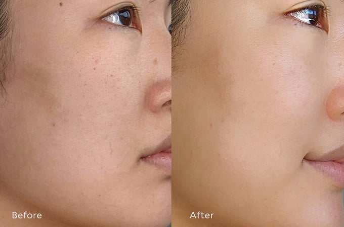 Tata Harper-Resurfacing Serum-