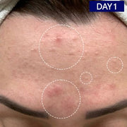 Odacite-Salicylic + Hyaluronic Acid Clarifying Serum-